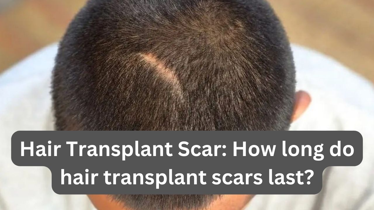 Hair Transplant Scar: How long do hair transplant scars last?