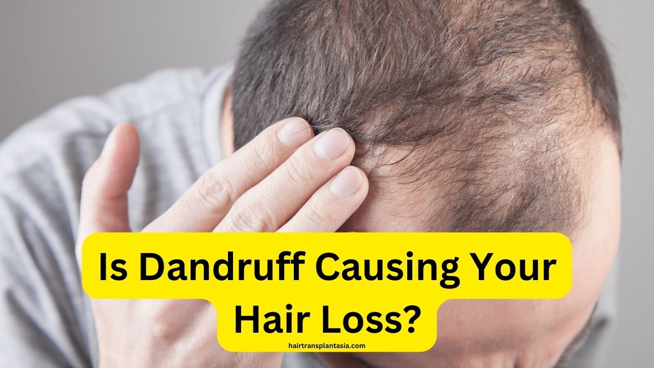 Is Dandruff Causing Your Hair Loss?
