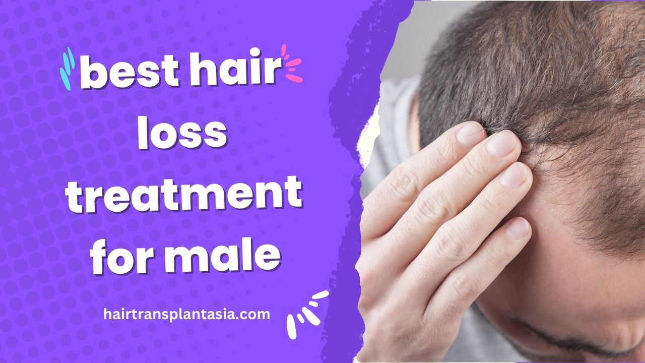 Best Hair Loss Treatment for Male