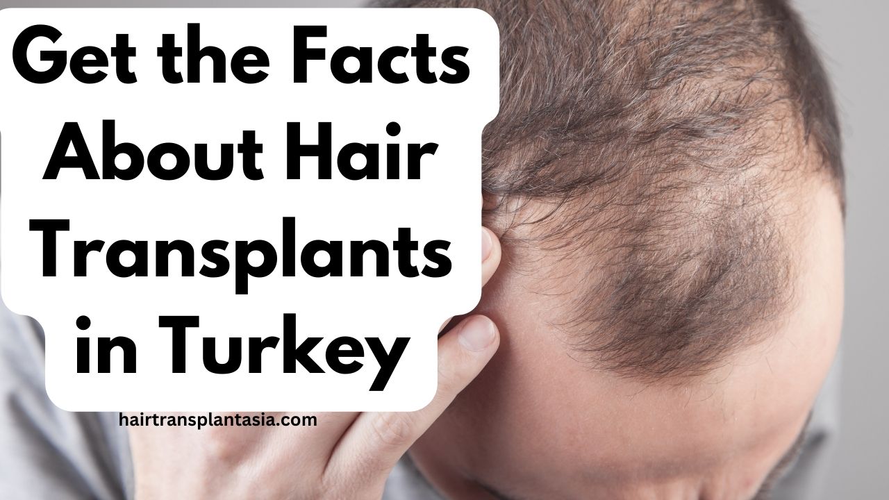Get the Facts About Hair Transplants in Turkey