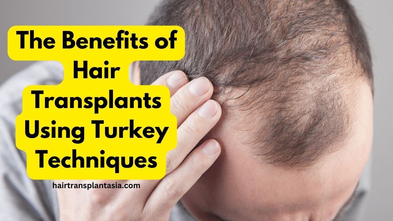 The Benefits of Hair Transplants Using Turkey Techniques