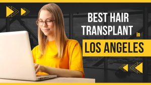 Best Hair Transplant in Los Angeles