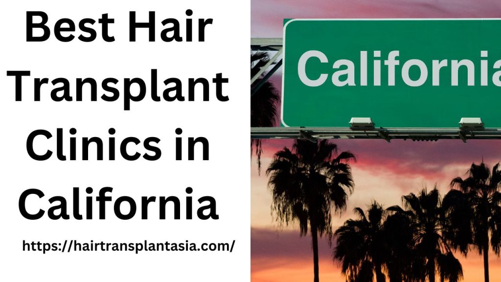 Best Hair Transplant Clinics in California