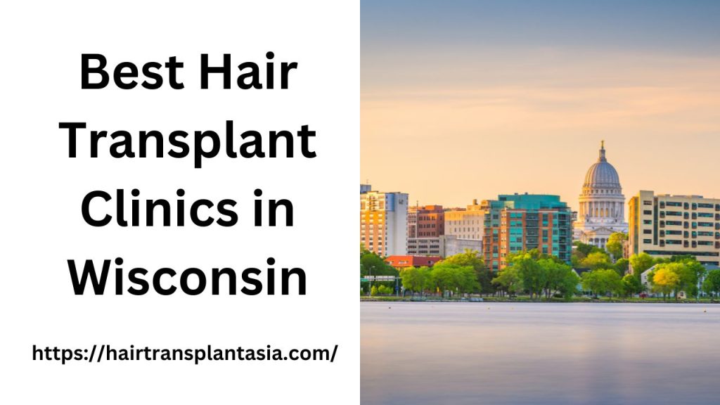 Best Hair Transplant Clinics in Wisconsin